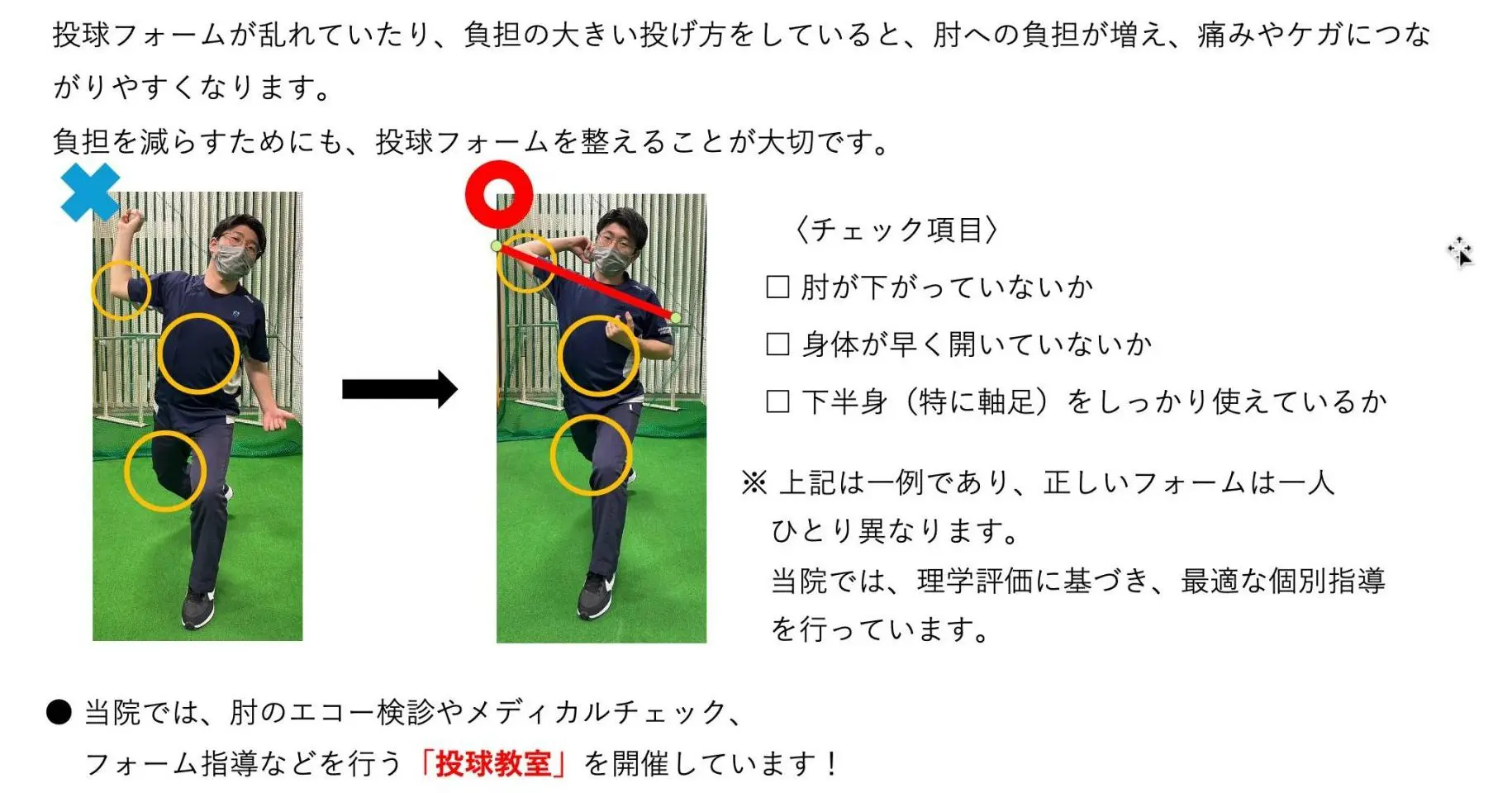 投球障害肩 | 鹿児島中央整形外科スポーツクリニック